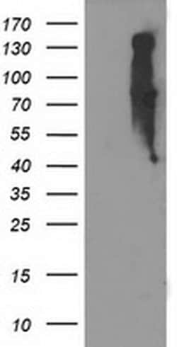 EIF2B3 Monoclonal Antibody (OTI2D2), TrueMAB , OriGene 100 &mu;L; Unconjugated:Antibodies,