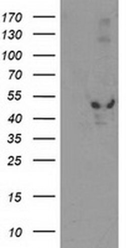 EIF2B3 Monoclonal Antibody (OTI1D6), TrueMAB , OriGene 30 &mu;L; Unconjugated:Antibodies,