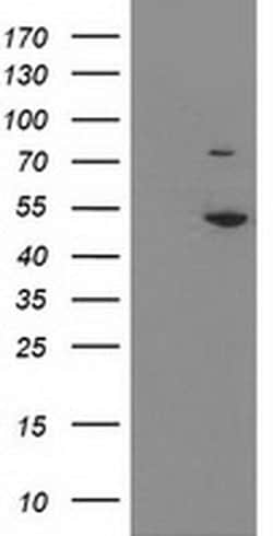 EIF2B3 Monoclonal Antibody (OTI3H3), TrueMAB , OriGene 100 &mu;L; Unconjugated:Antibodies,