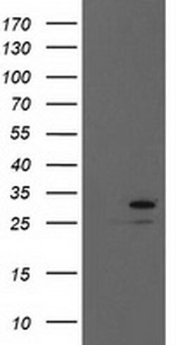 EIF4E Monoclonal Antibody (OTI6C11), TrueMAB , OriGene 100 &mu;L; Unconjugated:Antibodies,