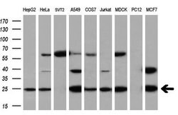 EIF4E Monoclonal Antibody (OTI6C11), TrueMAB , OriGene 100 &mu;L; Unconjugated:Antibodies,