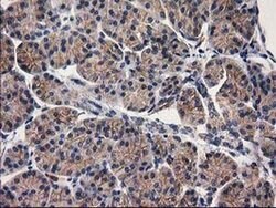 EIF4E2 Monoclonal Antibody (OTI1F2), TrueMAB , OriGene 100 &mu;L; Unconjugated:Antibodies,