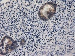 EIF4E2 Monoclonal Antibody (OTI1F2), TrueMAB , OriGene 100 &mu;L; Unconjugated:Antibodies,