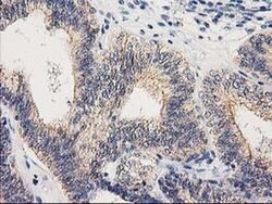 EIF4E2 Monoclonal Antibody (OTI1F2), TrueMAB , OriGene 100 &mu;L; Unconjugated:Antibodies,