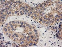 EIF4E2 Monoclonal Antibody (OTI1F2), TrueMAB , OriGene 100 &mu;L; Unconjugated:Antibodies,