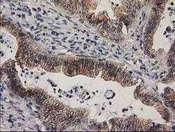 EIF4E2 Monoclonal Antibody (OTI1F2), TrueMAB , OriGene 100 &mu;L; Unconjugated:Antibodies,