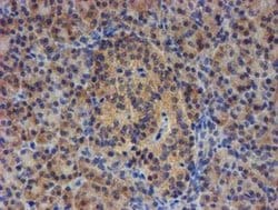EIF4E2 Monoclonal Antibody (OTI4E7), TrueMAB , OriGene 30 &mu;L; Unconjugated:Antibodies,