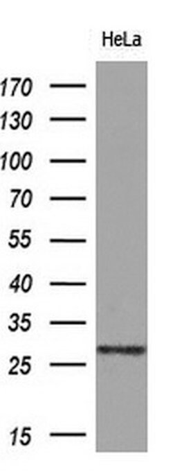 EIF4E2 Mouse anti-Human, Clone: OTI1F5, lyophilized, TrueMAB 100 &mu;g;