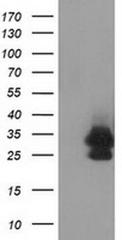EIF4E2 Monoclonal Antibody (OTI1F2), TrueMAB , OriGene 100 &mu;L; Unconjugated:Antibodies,