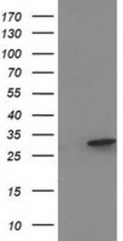 EIF4E2 Mouse anti-Human, Clone: OTI5D11, lyophilized, TrueMAB 100 &mu;g;
