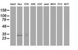 EIF4E2 Monoclonal Antibody (OTI5D11), TrueMAB , OriGene 100 &mu;L; Unconjugated:Antibodies,