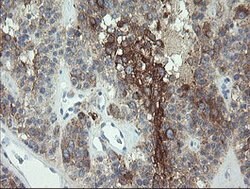 EIF5A2 Mouse anti-Human, Clone: OTI6F7, lyophilized, TrueMAB 100 &mu;g;