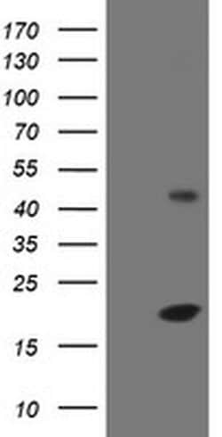 EIF5A2 Monoclonal Antibody (OTI2E9), TrueMAB , OriGene 100 &mu;L; Unconjugated:Antibodies,