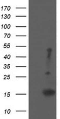 EIF5A2 Mouse anti-Human, Clone: OTI6F7, lyophilized, TrueMAB 100 &mu;g;