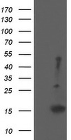 EIF5A2 Monoclonal Antibody (OTI6F7), TrueMAB , OriGene 100 &mu;L; Unconjugated:Antibodies,