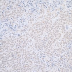 ELAC2 Rabbit anti-Human, Polyclonal, Bethyl Laboratories 100 &mu;L; Unconjugated:Antibodies,