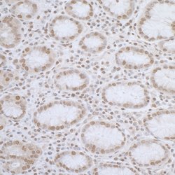 ELAC2 Rabbit anti-Human, Polyclonal, Bethyl Laboratories 100 &mu;L; Unconjugated:Antibodies,