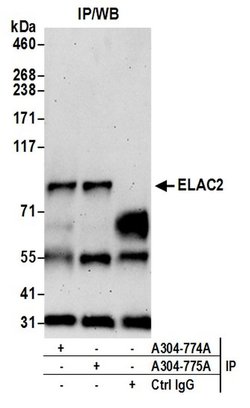 ELAC2 Rabbit anti-Human, Polyclonal, Bethyl Laboratories 100 &mu;L; Unconjugated:Antibodies,