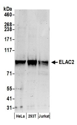 ELAC2 Rabbit anti-Human, Polyclonal, Bethyl Laboratories 100 &mu;L; Unconjugated:Antibodies,