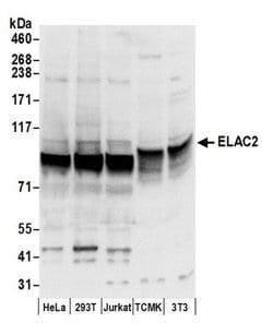 ELAC2 Polyclonal Antibody, Bethyl Laboratories:Antibodies:Primary Antibodies