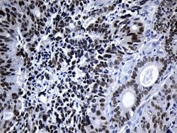 ELF3 Monoclonal Antibody (OTI2G6), TrueMAB , OriGene:Antibodies:Primary