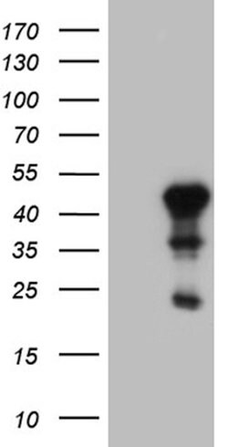 ELF3 Mouse anti-Human, Clone: OTI4G5, lyophilized, TrueMAB 100 &mu;g; Unconjugated:Antibodies,
