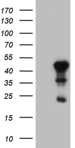 ELF3 Monoclonal Antibody (OTI4G5), TrueMAB , OriGene 100 &mu;L; Unconjugated:Anticorps,