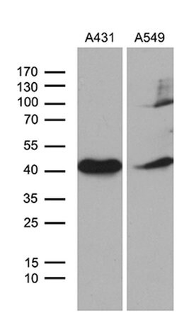 ELF3 Mouse anti-Human, Clone: OTI4G5, lyophilized, TrueMAB 100 &mu;g; Unconjugated:Antibodies,