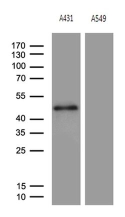 ELF3 Monoclonal Antibody (OTI2G6), TrueMAB , OriGene 100 &mu;L; Unconjugated:Antibodies,