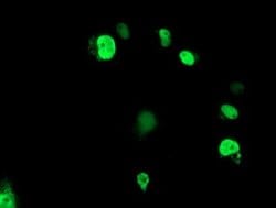 ELK3 Monoclonal Antibody (OTI3D9), TrueMAB , OriGene 100 &mu;L; Unconjugated:Antibodies,
