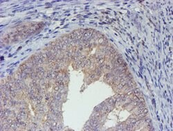 ELK3 Mouse anti-Human, Clone: OTI4G9, lyophilized, TrueMAB 100 &mu;g; Unconjugated:Antibodies,