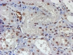 ELK3 Monoclonal Antibody (OTI4G9), TrueMAB , OriGene:Antibodies:Primary