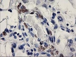 ELK3 Monoclonal Antibody (OTI2C10), TrueMAB , OriGene 100 &mu;L; Unconjugated:Antibodies,