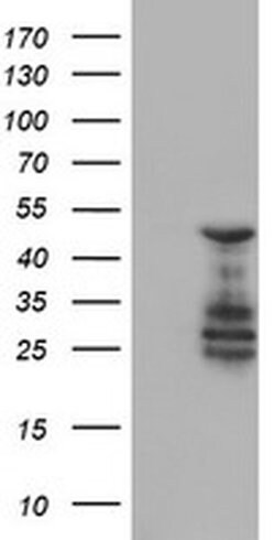 ELK3 Monoclonal Antibody (OTI4G9), TrueMAB , OriGene:Antibodies:Primary
