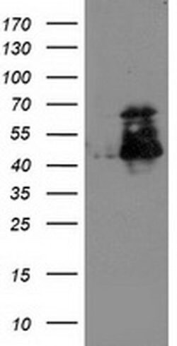ELK3 Monoclonal Antibody (OTI3D9), TrueMAB , OriGene 100 &mu;L; Unconjugated:Antibodies,