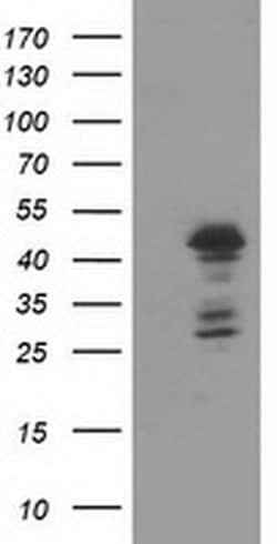 ELK3 Monoclonal Antibody (OTI1A6), TrueMAB , OriGene 100 &mu;L; Unconjugated:Antibodies,