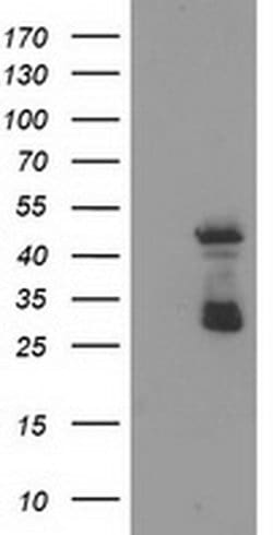 ELK3 Monoclonal Antibody (OTI2F12), TrueMAB , OriGene:Antibodies:Primary