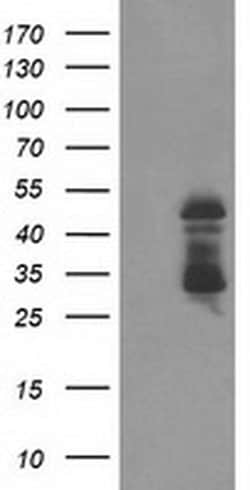 ELK3 Monoclonal Antibody (OTI2C10), TrueMAB , OriGene 100 &mu;L; Unconjugated:Antibodies,