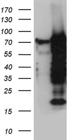 ELL Monoclonal Antibody (OTI3A8), TrueMAB , OriGene 100 &mu;L; Unconjugated:Antibodies,