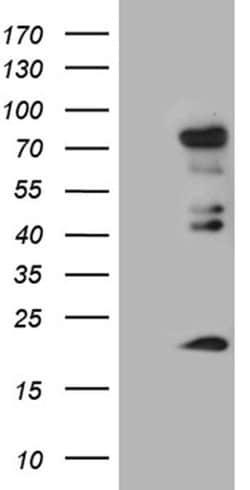 ELL Monoclonal Antibody (OTI4C4), TrueMAB , OriGene:Anticorps:Anticorps