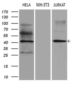 ELP4 Monoclonal Antibody (OTI3A4), TrueMAB , OriGene 100 &mu;L; Unconjugated:Antibodies,