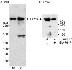ELYS Rabbit anti-Human, Polyclonal, Bethyl Laboratories 100 &mu;L; Unconjugated:Antibodies,
