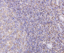 CD44 Monoclonal Antibody (A7-1), Huabio 100 &mu;L; Unconjugated:Antibodies,