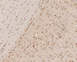 HSP90 Beta Monoclonal Antibody (2-1-G3), Huabio 100 &mu;L; Unconjugated:Antibodies,
