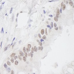 EMSY Polyclonal Antibody, Bethyl Laboratories 10 &mu;L; Unconjugated:Antibodies,