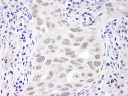 EMSY Polyclonal Antibody, Bethyl Laboratories 10 &mu;L; Unconjugated:Antibodies,