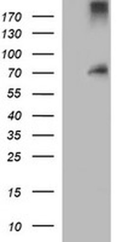 ENG Monoclonal Antibody (OTI8B8), TrueMAB , OriGene 100 &mu;L; Unconjugated:Antibodies,
