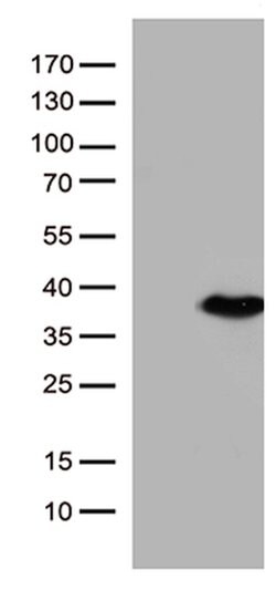 ENOPH1 Mouse anti-Human, Clone: OTI4A8, lyophilized, TrueMAB 100 &mu;g;