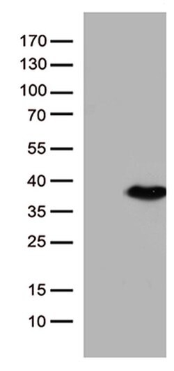 ENOPH1 Monoclonal Antibody (OTI4A8), TrueMAB , OriGene 30 &mu;L; Unconjugated:Antibodies,