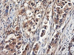 ENPEP Monoclonal Antibody (OTI3E7), TrueMAB , OriGene 30 &mu;L; Unconjugated:Antibodies,